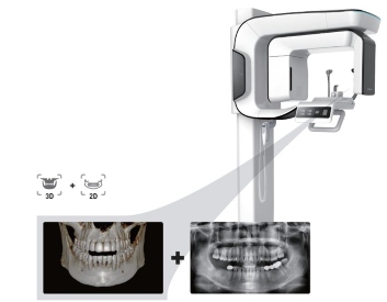 3D CBCT Dental Scan for Implants at HappyDental